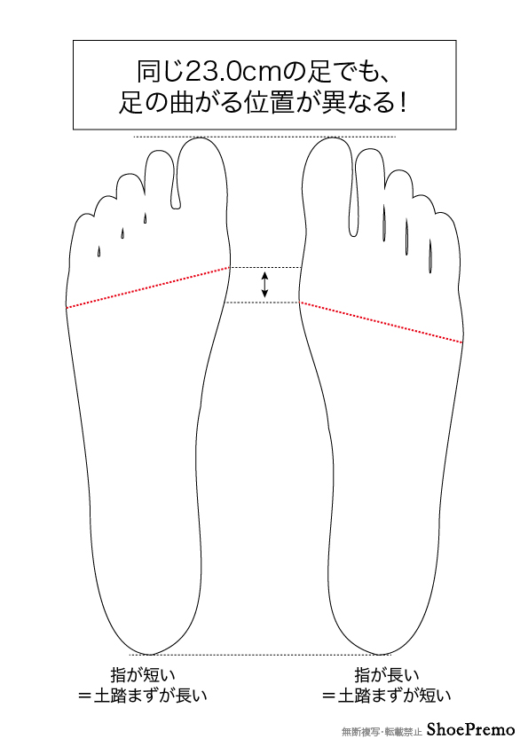 balljoint